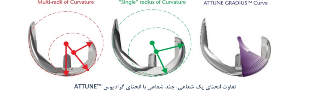 مزایای پروتز زانوی ATTUNE